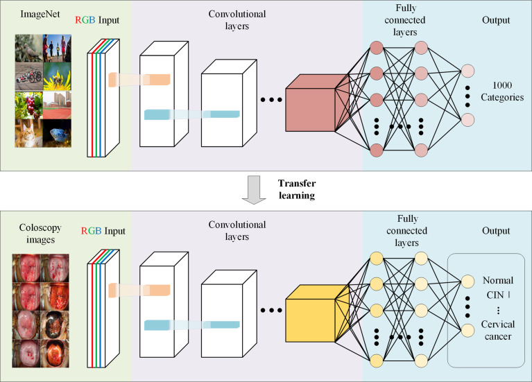 AI-assisted VIA Screening of Cervical Cancer