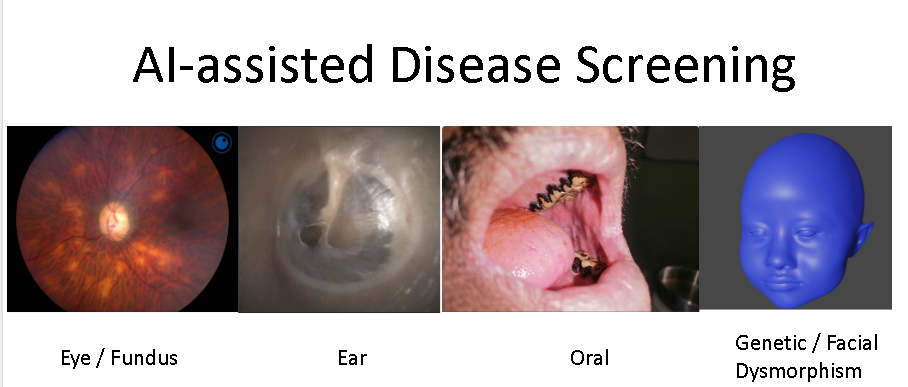 AI-Assisted Telehealth and Screening for Vision-, Hearing-, Oral, and Genetic Diseases