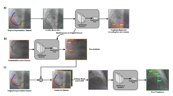 AI-Enhanced Coronary Artery Disease Diagnostics from X-Ray Angiography