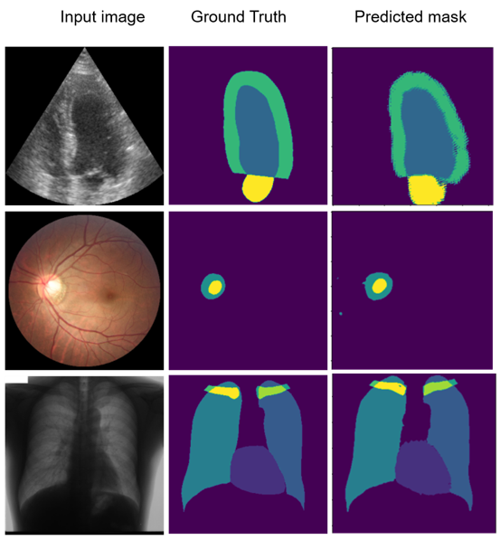 Semi-supervised segmentation of medical images.